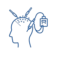 Hair_Transplant-removebg-preview