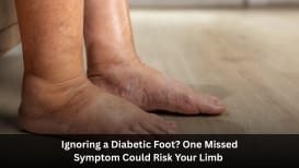 Ignoring a Diabetic Foot? One Missed Symptom Could Risk Your Limb — Here’s How Vascular Care Saves It