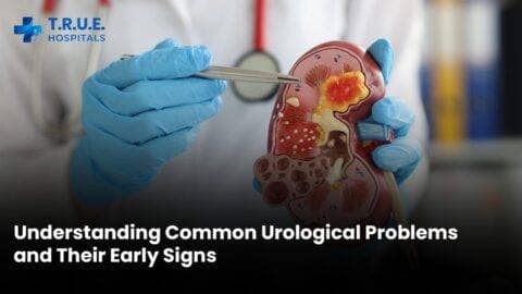 Understanding Common Urological Problems and Their Early Signs