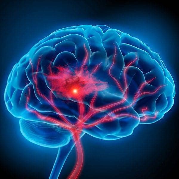 ORTHOPEDICS Orthopedic